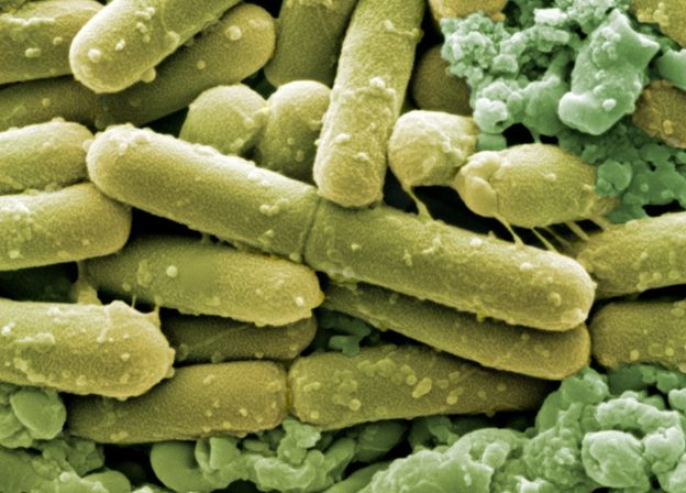 The Persistent Challenge of C. diff: A Journey Through History to Modern Science