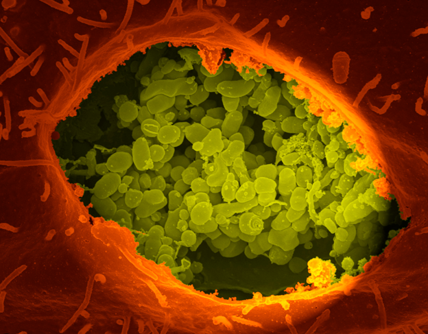 Coxiella burnetii: Unveiling the Stealth Pathogen Behind Q Fever
